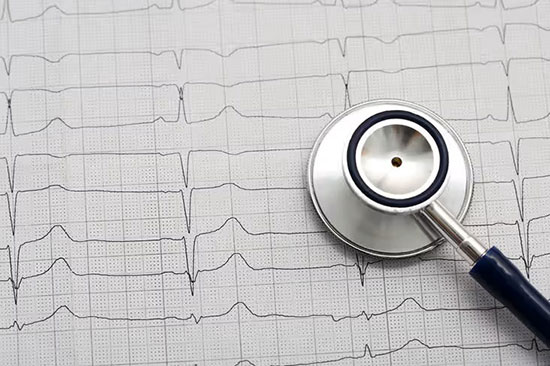 electrocardiogram1